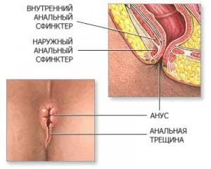 анална