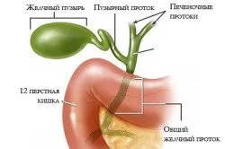 отстраняване