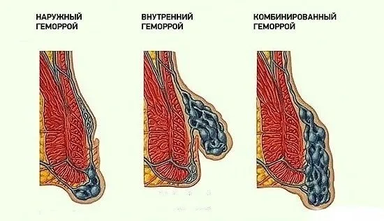 вътрешни