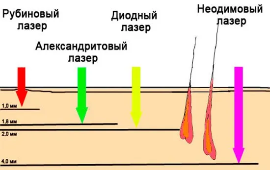 лазерно