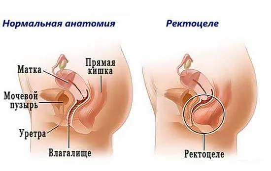 възникват