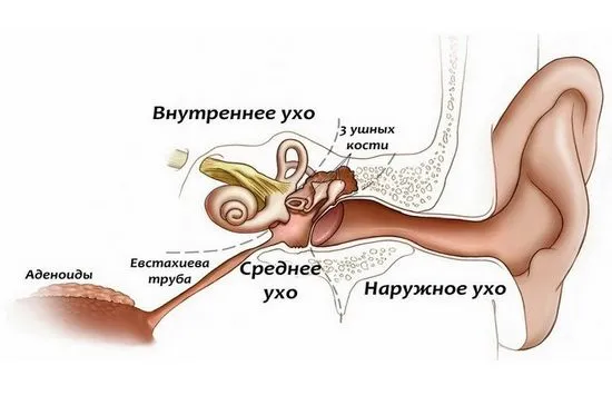 Хроничен отит - причини, симптоми, лечение