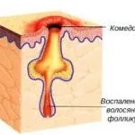 точки