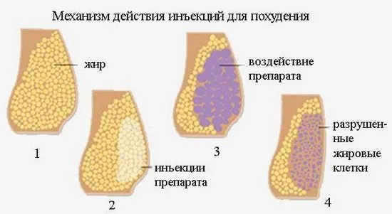 Инжекции за отслабване