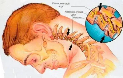 Cum să crești tensiunea arterială acasă rapid și eficient