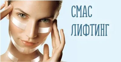 Există vreun beneficiu de la un lifting facial hardware SMAS-lifting?