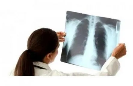 Cum să tratezi pneumonia acasă