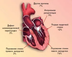 Algoritm de șoc cardiogen pentru furnizarea de îngrijiri de urgență