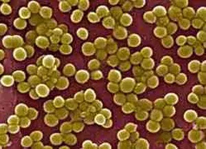 Tratamentul Staphylococcus aureus patogen în nas