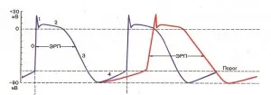 cardiacă