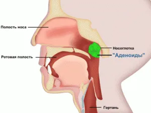 Adenoide la copii