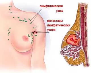 diagnosticul