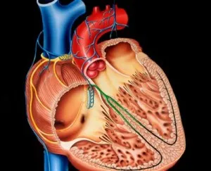 Miocardiodistrofie în detaliu, principalele simptome și tratamentul bolii