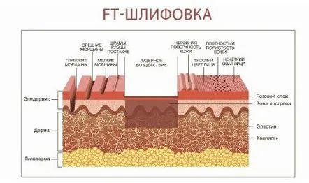 cicatricilor