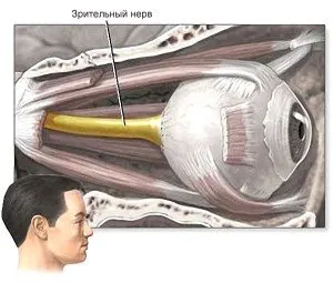 Atrofia nervului optic