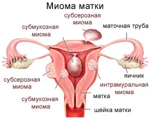 uterul