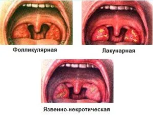 antibiotice