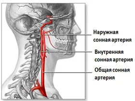 anevrismului