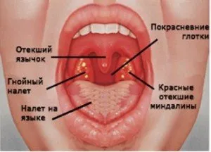 antibiotice