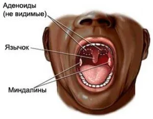 Și știi cum să vindeci angina într-o zi