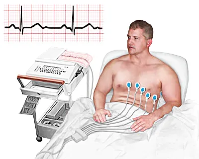 Cum să înveți să efectuezi și să interpretezi un ECG