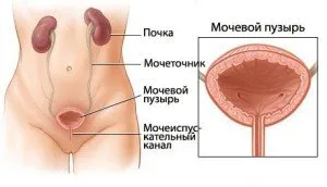 Boli ale vezicii urinare