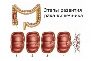 intestinal