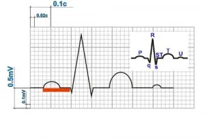 electrocardiogramă