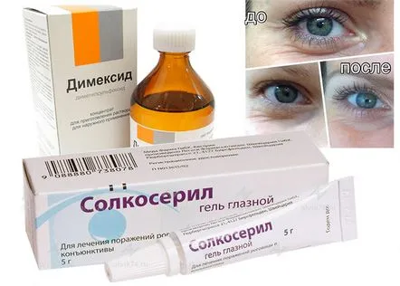 Dimexide și Solcoseryl din riduri, recenzii ale cosmetologilor