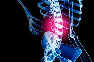 Ce poate fi protruzia periculoasă a vertebrelor cervicale, toracice și coloanei vertebrale lombare