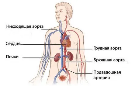 Intestinal angina - simptome, tratament, consiliere de specialitate