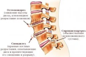 coloanei