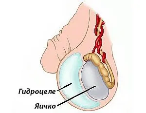 nou-născuți