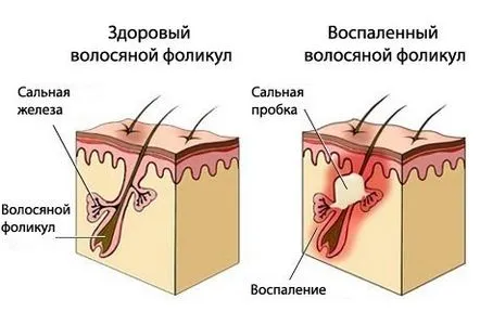 acasă