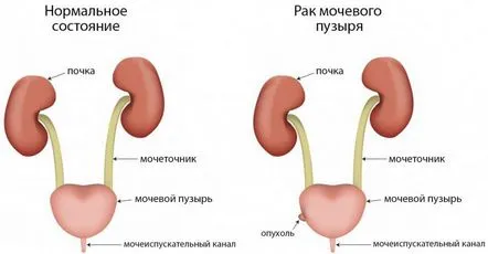 мехур