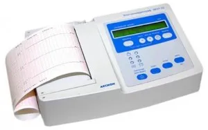 Indicatori normali de electrocardiogramă