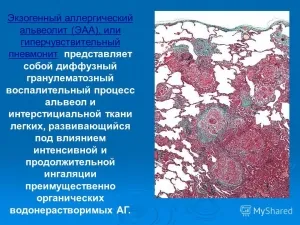 Alveolita pulmonară alergică și tratamentul acesteia