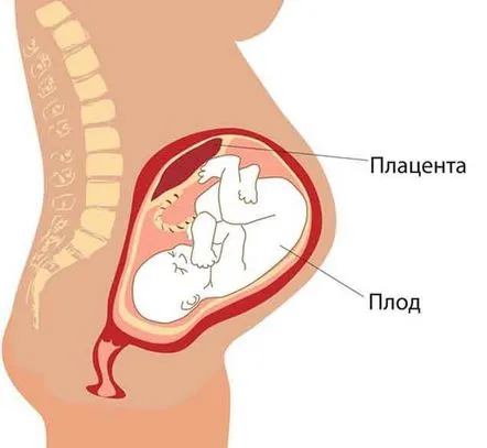 Placenta joasă în timpul sarcinii