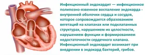 Simptome caracteristice și caracteristici ale tratamentului endocarditei infecțioase