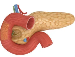 Meniu pentru boala pancreatică