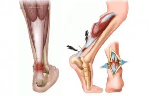 ligamente