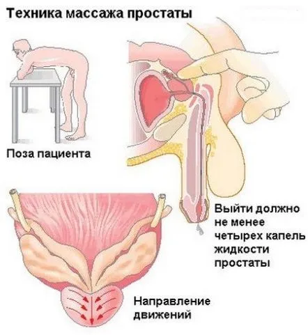 простатата