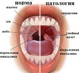 tratamentul