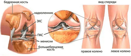 Ruptura ligamentelor articulației genunchiului semne, prim ajutor și diagnostic