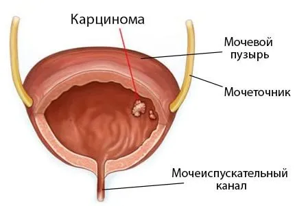 лечение