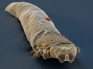 Cum să scapi de un acarien demodex