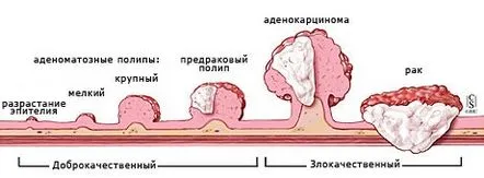 rectal