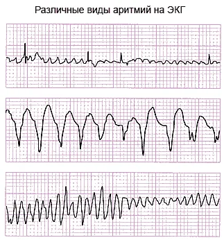 diferitelor