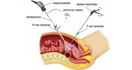 uterine