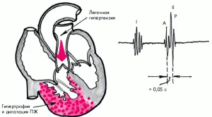 cardiacă